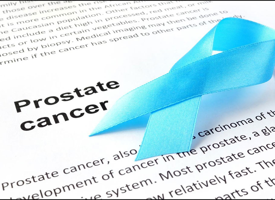 Specialist Urologist Doctor Sydney: Dr. David Ende -Prostate Cancer
